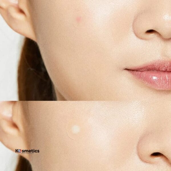 [COSRX] Master Pimple Patch Basic (90 unidades) - Image 3